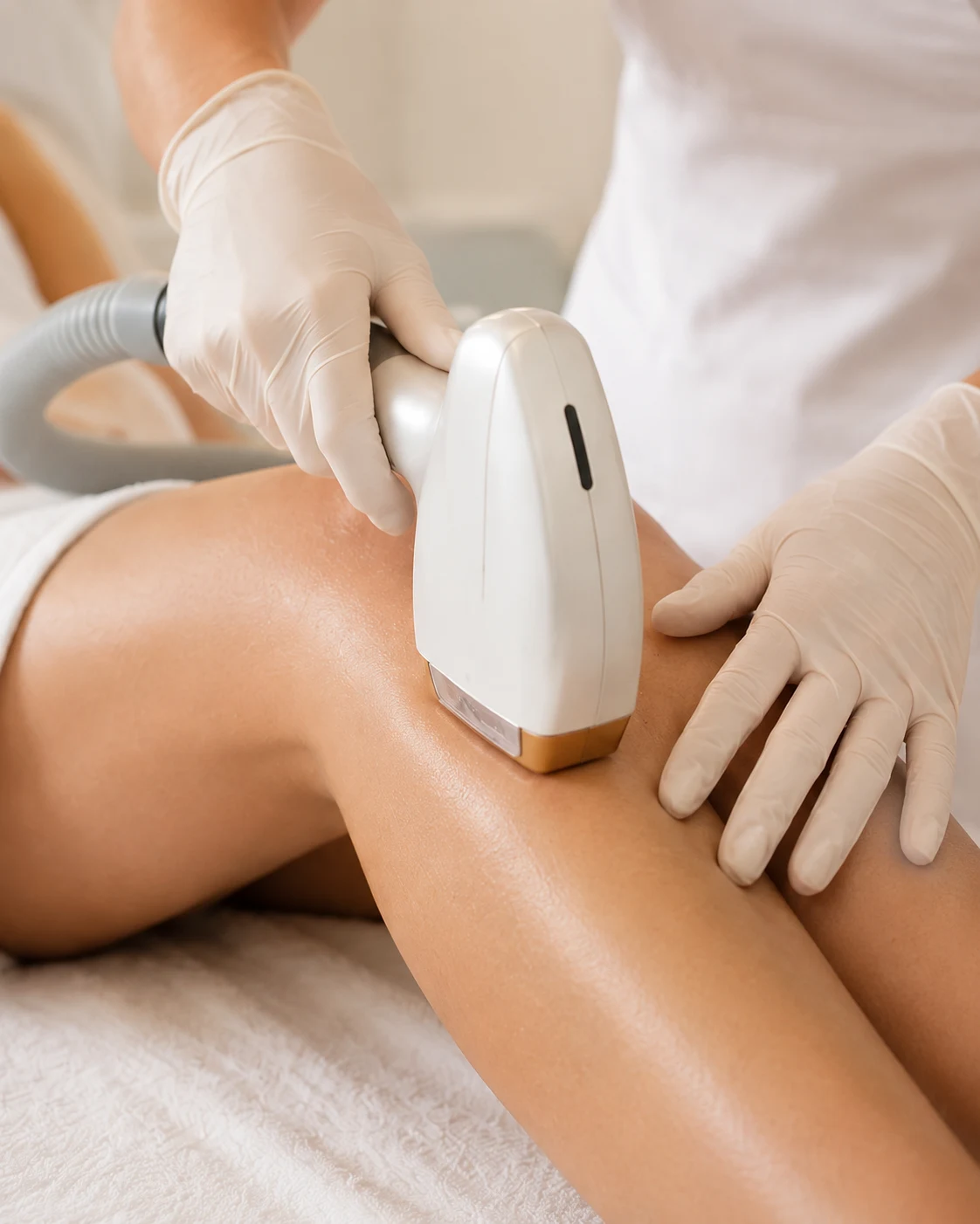 Epilazione laser